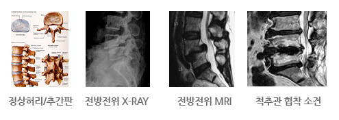 척추센터