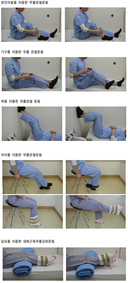 인공관절센터